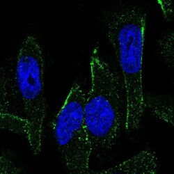 MEX3C Antibody, Novus Biologicals 0.1mL; Unlabeled:Antibodies, Polyclonal